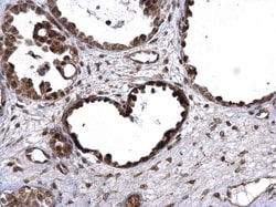 Invitrogen E6AP Polyclonal Antibody 100 &mu;L; Unconjugated:Antibodies,