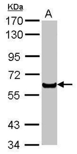 Invitrogen PPAR alpha Polyclonal Antibody 100 &mu;L; Unconjugated:Antibodies,