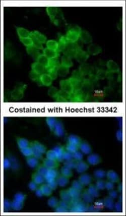 Invitrogen LPL Polyclonal Antibody 100 &mu;L; Unconjugated:Antibodies,