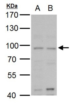 Invitrogen MLH1 Polyclonal Antibody 100 &mu;L; Unconjugated:Antibodies,