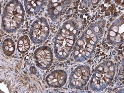 Decorin Polyclonal Antibody:Antibodies, Polyclonal