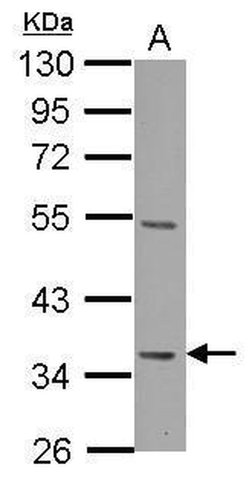Decorin Polyclonal Antibody:Antibodies, Polyclonal