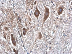 Invitrogen beta Tubulin Polyclonal Antibody 100 &mu;L | Buy Online | Invitrogen&trade; | Fisher Scientific