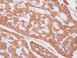 Invitrogen beta Tubulin Polyclonal Antibody 100 &mu;L | Buy Online | Invitrogen&trade; | Fisher Scientific