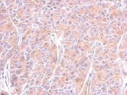 Invitrogen beta Tubulin Polyclonal Antibody 100 &mu;L | Buy Online | Invitrogen&trade; | Fisher Scientific