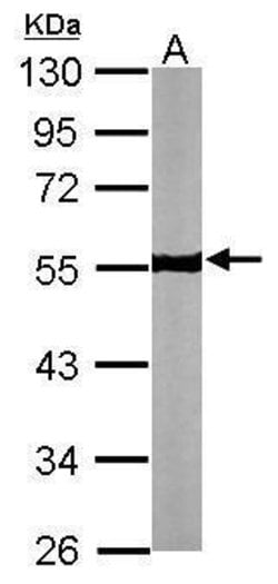 Invitrogen beta Tubulin Polyclonal Antibody 100 &mu;L | Buy Online | Invitrogen&trade; | Fisher Scientific