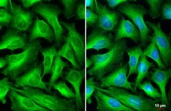 Invitrogen beta Tubulin Polyclonal Antibody 100 &mu;L | Buy Online | Invitrogen&trade; | Fisher Scientific