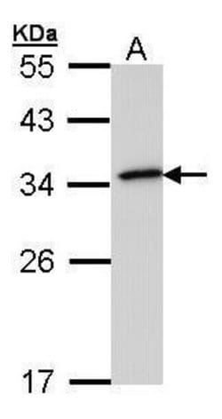 Invitrogen NQO1 Polyclonal Antibody 100 &mu;L | Buy Online | Invitrogen&trade; | Fisher Scientific