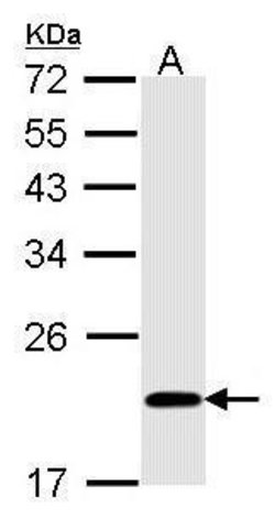 Invitrogen BID Polyclonal Antibody 100 &mu;L; Unconjugated:Antibodies,
