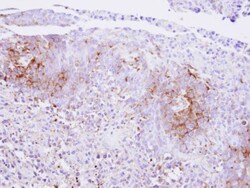 Invitrogen Calcium Sensing Receptor Polyclonal Antibody 100 &mu;L | Buy Online | Invitrogen&trade; | Fisher Scientific