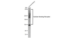 Invitrogen Calcium Sensing Receptor Polyclonal Antibody 100 &mu;L | Buy Online | Invitrogen&trade; | Fisher Scientific