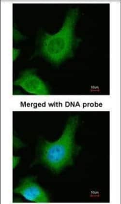 Invitrogen™ Calcium Sensing Receptor Polyclonal Antibody