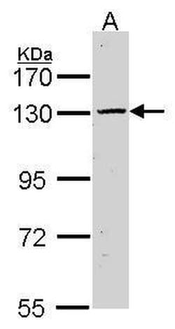 Calcium Sensing Receptor Rabbit anti-Human, Mouse, Polyclonal, Invitrogen