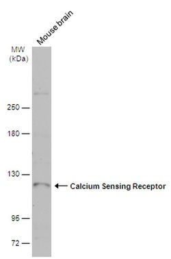 Calcium Sensing Receptor Rabbit anti-Human, Mouse, Polyclonal, Invitrogen