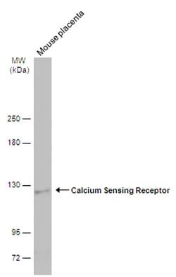 Calcium Sensing Receptor Rabbit anti-Human, Mouse, Polyclonal, Invitrogen
