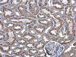 Invitrogen ACADM Polyclonal Antibody 100 &mu;L; Unconjugated:Antibodies,