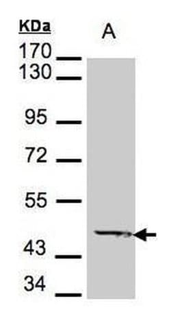 Invitrogen ACADM Polyclonal Antibody 100 &mu;L; Unconjugated:Antibodies,
