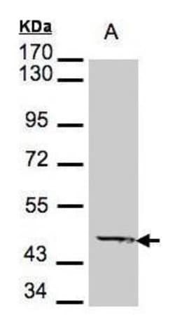 Invitrogen ACADM Polyclonal Antibody 100 &mu;L; Unconjugated:Antibodies,