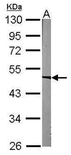 Invitrogen ACADM Polyclonal Antibody 100 &mu;L; Unconjugated:Antibodies,
