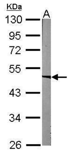 Invitrogen ACADM Polyclonal Antibody 100 &mu;L; Unconjugated:Antibodies,