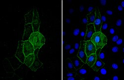 ACE2 Polyclonal Antibody, Invitrogen&trade;