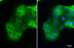 ACE2 Polyclonal Antibody, Invitrogen&trade;