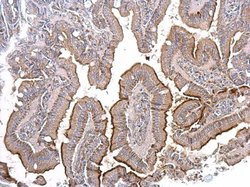 ACE2 Polyclonal Antibody, Invitrogen&trade;