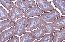 ACE2 Polyclonal Antibody, Invitrogen&trade;