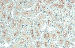 ACE2 Polyclonal Antibody, Invitrogen&trade;