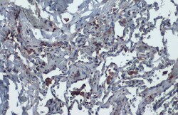 ACE2 Polyclonal Antibody, Invitrogen&trade;