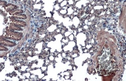 ACE2 Polyclonal Antibody, Invitrogen&trade;