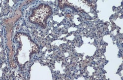 ACE2 Polyclonal Antibody, Invitrogen&trade;