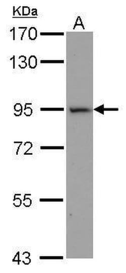 ACE2 Polyclonal Antibody, Invitrogen&trade;
