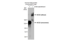 ACE2 Polyclonal Antibody, Invitrogen&trade;