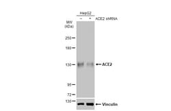 Invitrogen ACE2 Polyclonal Antibody 100 &mu;L | Buy Online | Invitrogen&trade; | Fisher Scientific