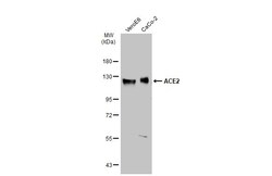 ACE2 Polyclonal Antibody, Invitrogen&trade;