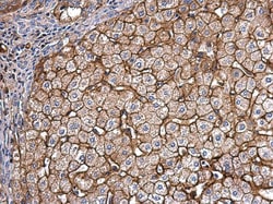 Invitrogen APOE Polyclonal Antibody 100 &mu;L; Unconjugated:Antibodies,