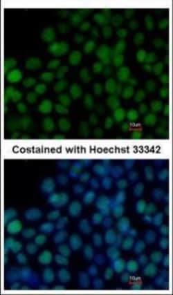 Invitrogen SOX2 Polyclonal Antibody 100 &mu;L; Unconjugated:Antikörper