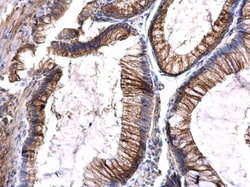 Invitrogen FLT3 Polyclonal Antibody 100 &mu;L; Unconjugated:Antibodies,