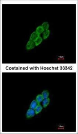 Invitrogen LTBP4 Polyclonal Antibody 100 &mu;L | Buy Online | Invitrogen&trade; | Fisher Scientific