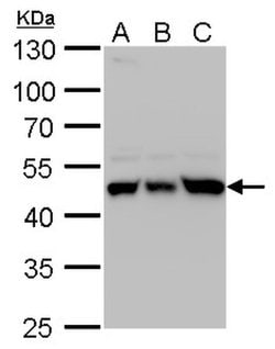 Invitrogen UQCRC1 Polyclonal Antibody 100 &mu;L; Unconjugated:Antibodies,