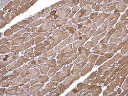Invitrogen alpha-Cardiac Actin Polyclonal Antibody 100 &mu;L | Buy Online | Invitrogen&trade; | Fisher Scientific