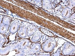 Invitrogen alpha-Cardiac Actin Polyclonal Antibody 100 &mu;L | Buy Online | Invitrogen&trade; | Fisher Scientific