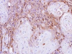 Invitrogen Peripherin Polyclonal Antibody 100 &mu;L; Unconjugated:Antibodies,