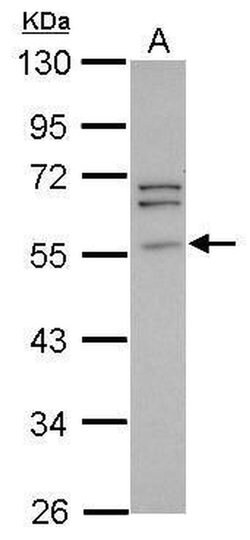 Invitrogen Peripherin Polyclonal Antibody 100 &mu;L; Unconjugated:Antibodies,
