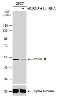 Invitrogen hnRNP H1 Polyclonal Antibody 100 &mu;L; Unconjugated:Antibodies,
