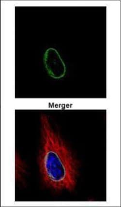 Invitrogen POM121 Polyclonal Antibody 100 &mu;L; Unconjugated:Antibodies,