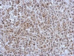 Invitrogen POM121 Polyclonal Antibody 100 &mu;L; Unconjugated:Antibodies,