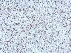 Invitrogen POM121 Polyclonal Antibody 100 &mu;L; Unconjugated:Antibodies,