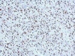 Invitrogen POM121 Polyclonal Antibody 100 &mu;L; Unconjugated:Antibodies,